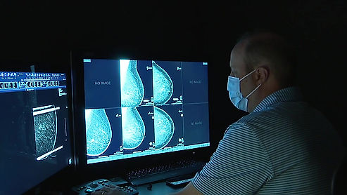 Cancer doesn't care about COVID: Pandemic poses threat to breast cancer diagnoses
